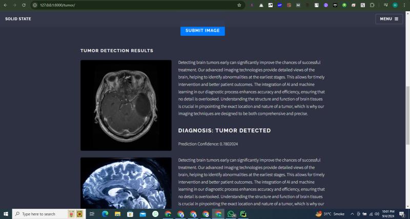 Brain Tumor Detection System